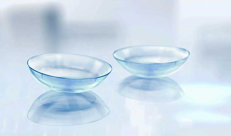 Servizi Ottica Dolo Servizi